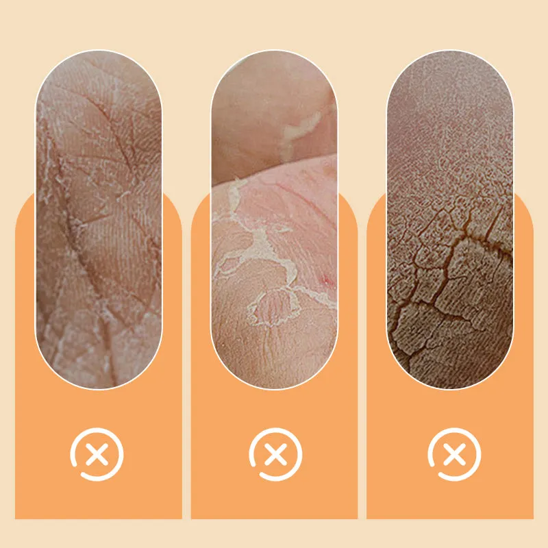 2025 HOT SALE Anti-Dryness Moisturizing Horse Oil Hand Cream