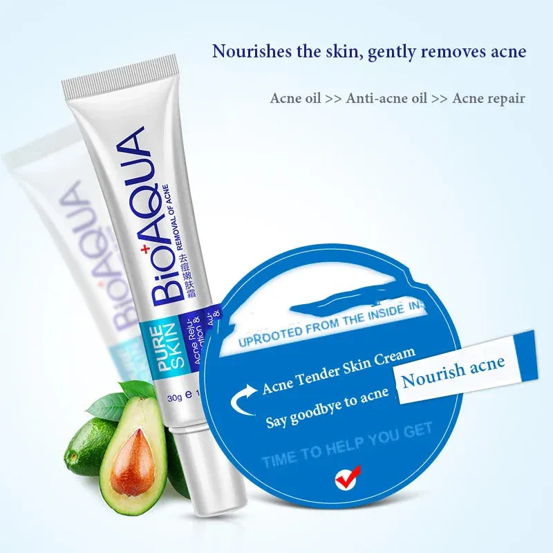 Acne Treatment Cream Pore Minimizing & Blackhead Removal