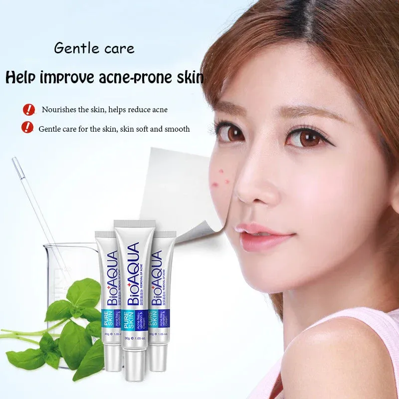 Acne Treatment Cream Pore Minimizing & Blackhead Removal