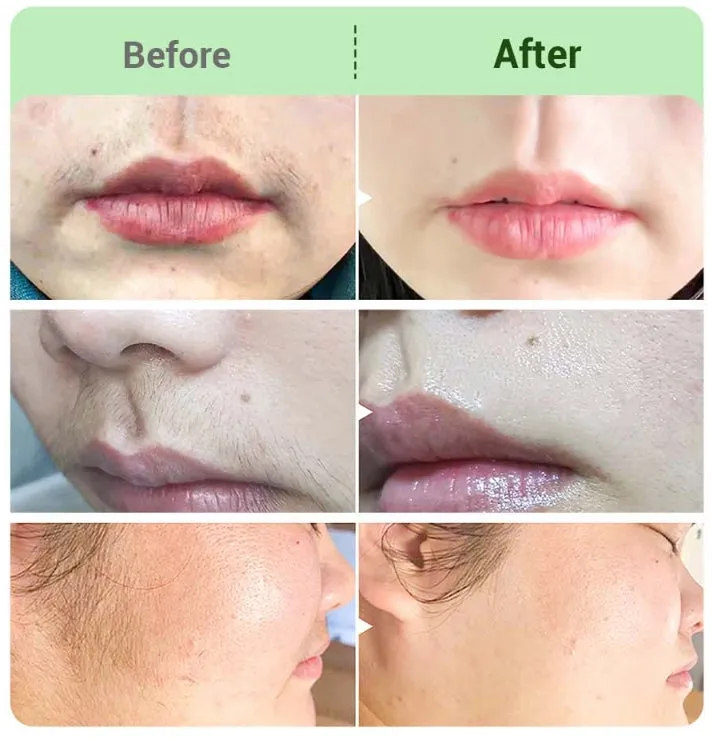 BUY 2 GET 1 FREEHair Removal Cream Kit for Women